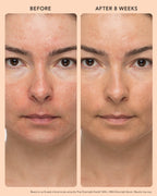 Before and after results showing smoother, more even skin after using AHA-BHA.
