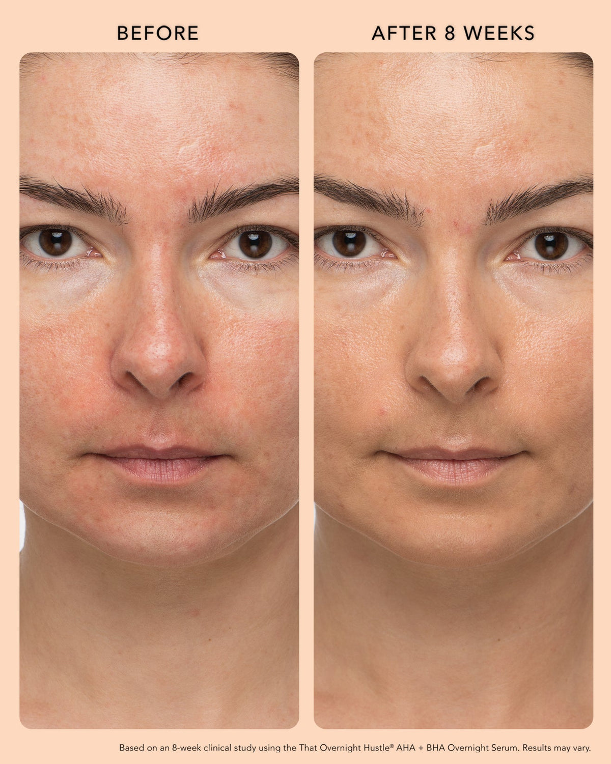 Before and after results showing smoother, more even skin after using AHA-BHA.