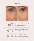 Results graphic from use of the Serum and Hydrating Cream, showing before-and-after close-ups of a person's eye area, with text claiming 100% improvement in skin hydration, 97% in skin firmness, and 94% in visibly softer and smoother texture