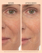 Marketing graphic showing eye and mouth wrinkles labelled BEFORE and AFTER 8 weeks suggesting improvement in wrinkle smoothness.