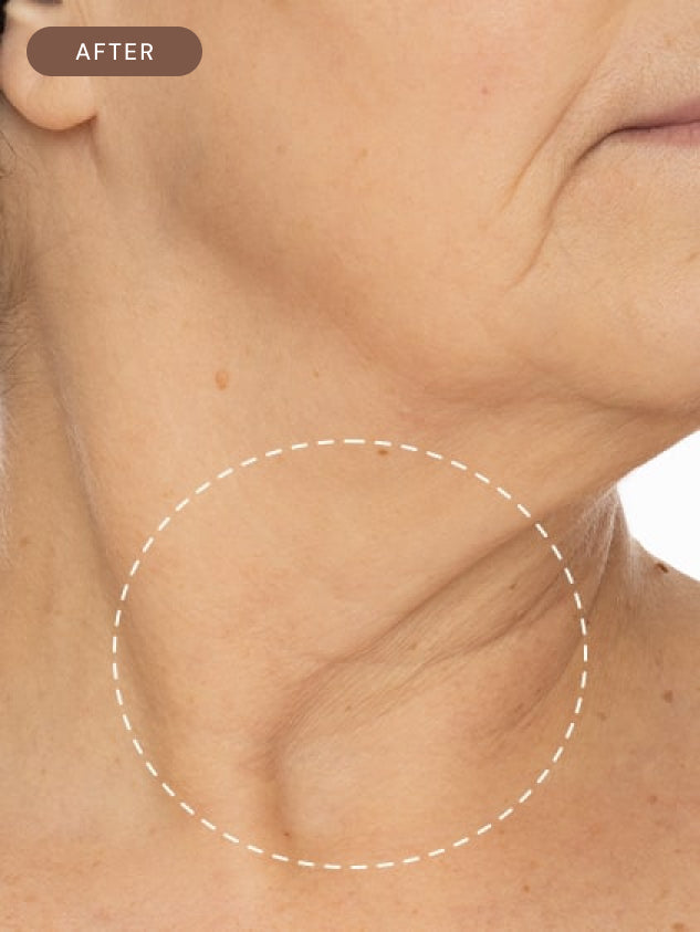 Firming Neck Serum 