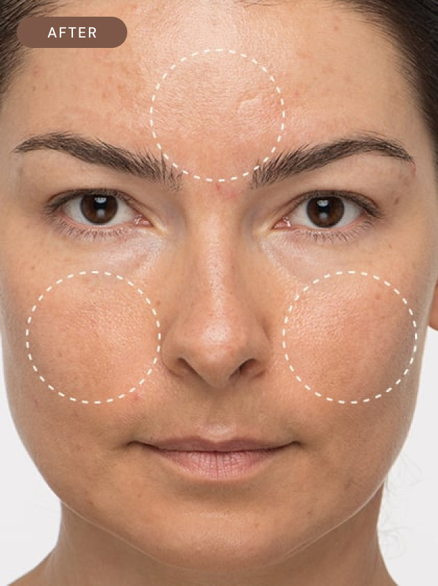 AHA + BHA Overnight Serum