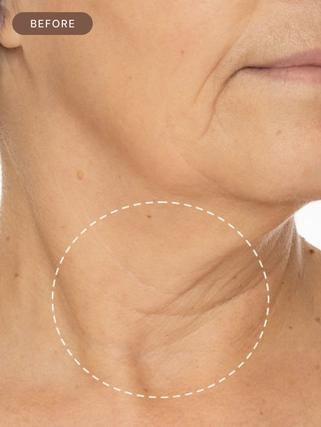 Firming Neck Serum 