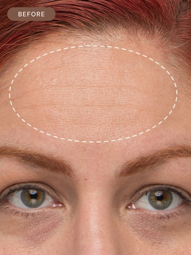 AHA + BHA Overnight Serum 