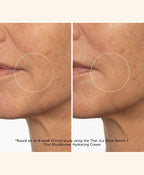 Before and after comparison of a person's skin around the mouth area, with text indicating a clinical study on skincare products.