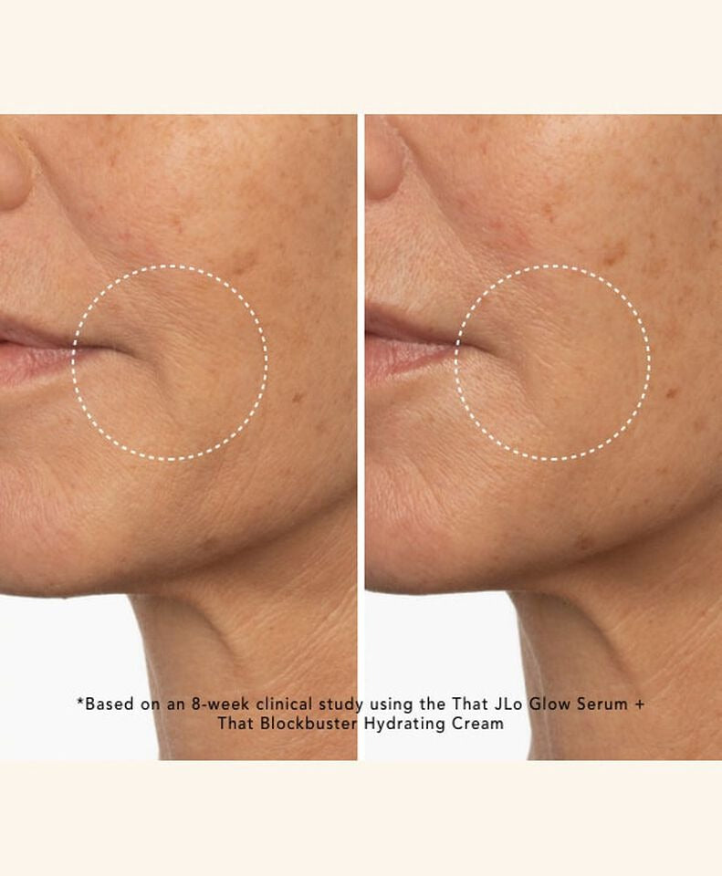 Before and after comparison of a person's skin around the mouth area, with text indicating a clinical study on skincare products.