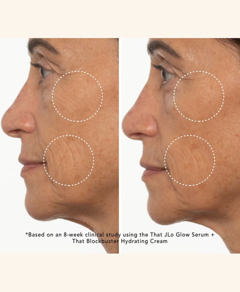 Before and after comparison of wrinkes after usage of The JLO Glow Serum + Hydrating Cream. 
