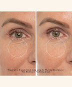 Before and after comparison of eye area with a product claim on a beige background