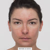 Close-up video of a model's face showing smoother skin after using AHA-BHA.