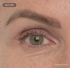 Video showing Before and After of under eye wrinkles and side of mouth wrinkles suggestion improvement.